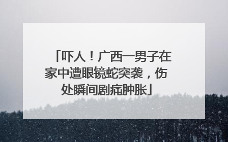 吓人！广西一男子在家中遭眼镜蛇突袭，伤处瞬间剧痛肿胀